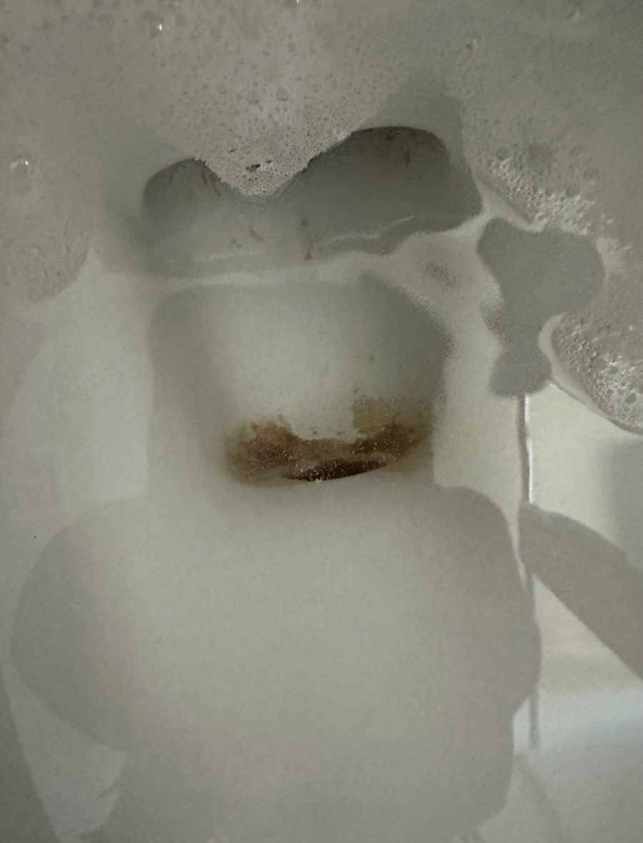 Toilet bowl before cleaning